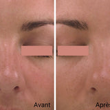 ALGOMASK+ - 60 minutes