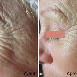 BOTINOL - 60 minutes