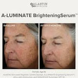 A-Luminate Sérum Éclaircissant