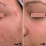 SOIN OXYGÉNANT - 60 minutes